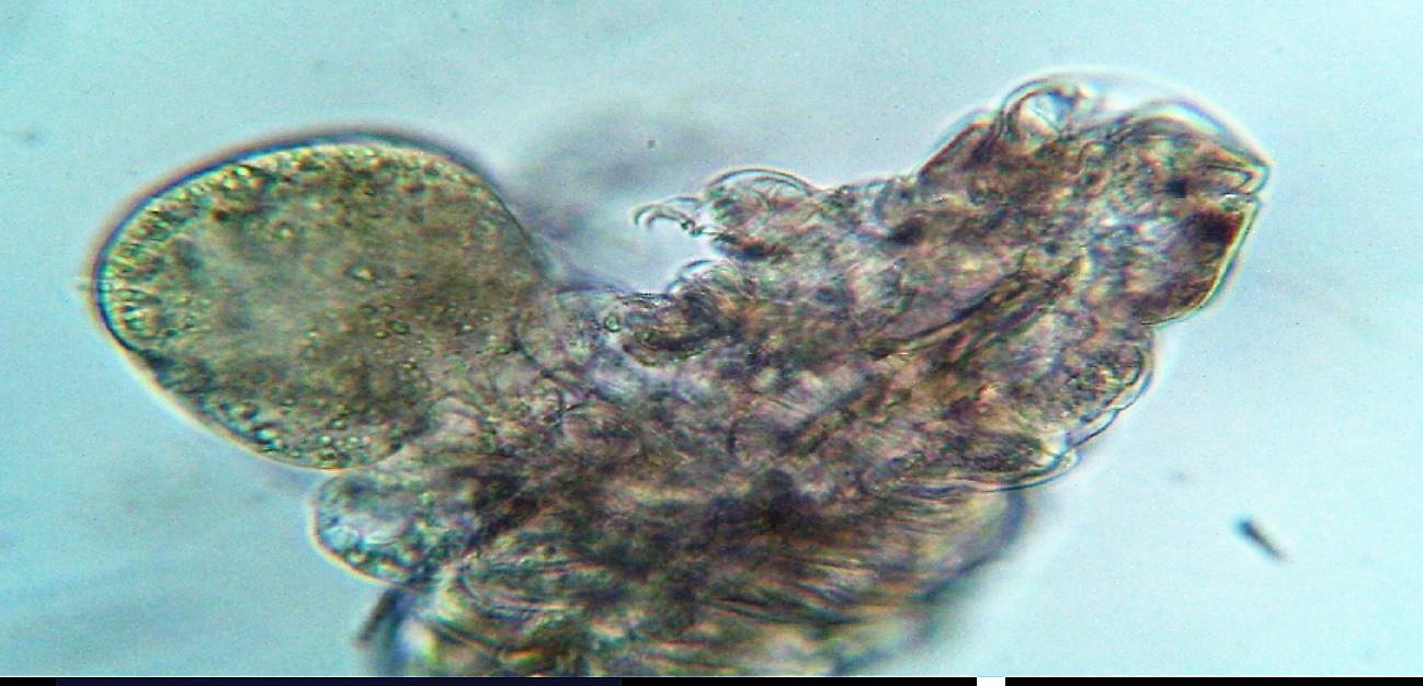 Didium sp attacca un Tardigrado! Possibile?